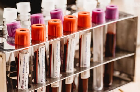 Blood Banks